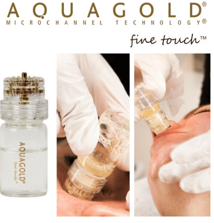 med spa professional applying aquagold microchannel skin treatment