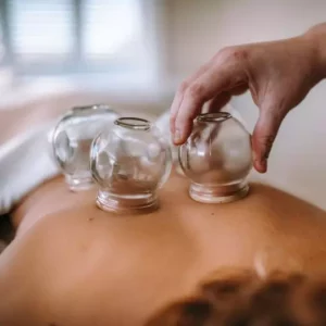 woman receiving cupping therapy on back